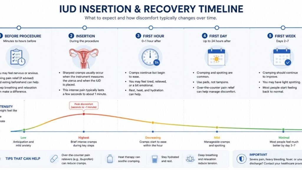 Timeline showing when pain is usually strongest before, during, and after IUD insertion.